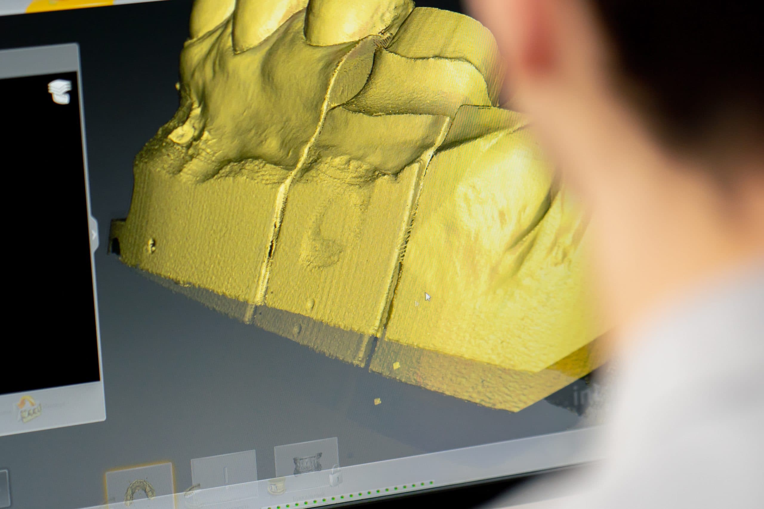 Configuração de notebook para CAD/CAM Dental